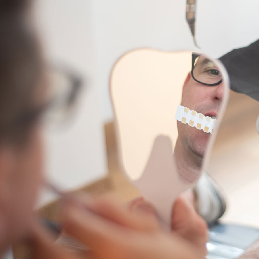 Home Bleaching im Selbstverfahren