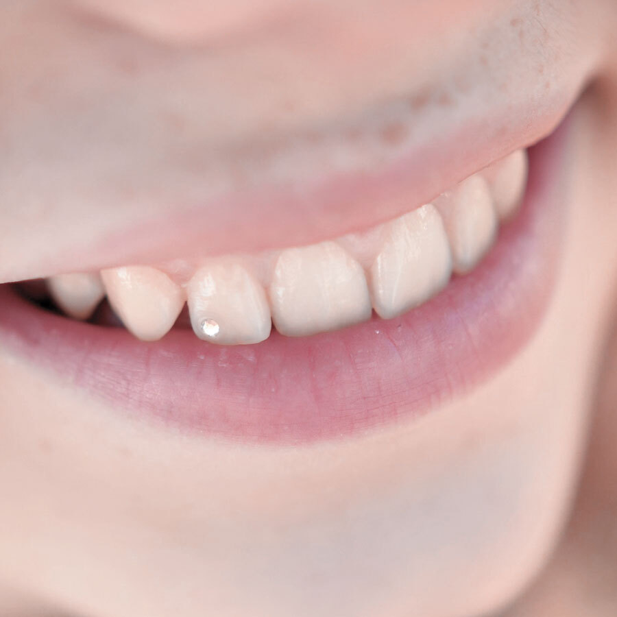 Zahnsteine kleben für Kinder